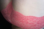 Assets