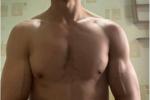 breast